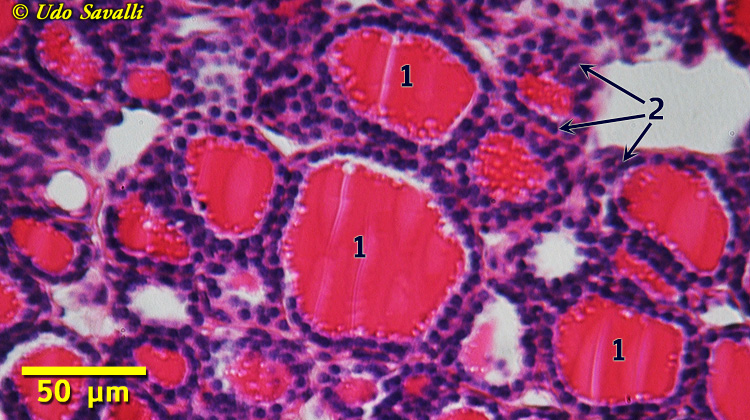 Thyroid Histology