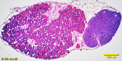 thyroid & parathyroid gland