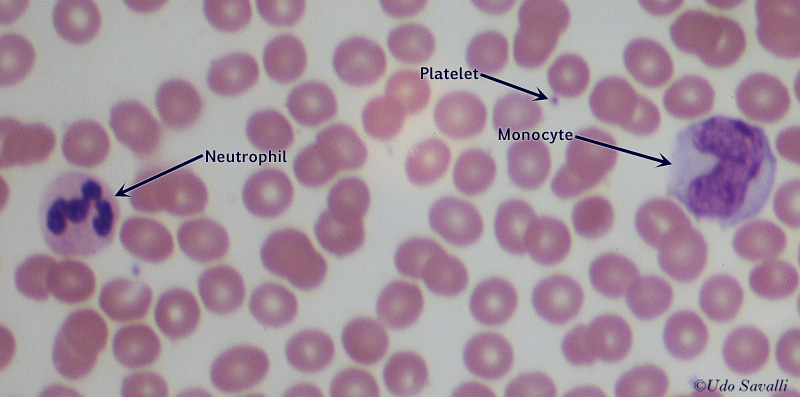 Blood Smear