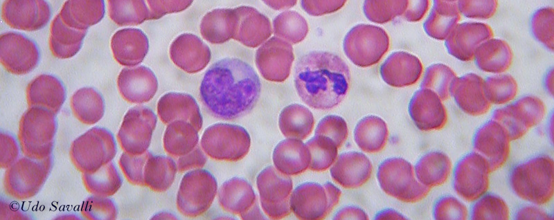 Blood Smear