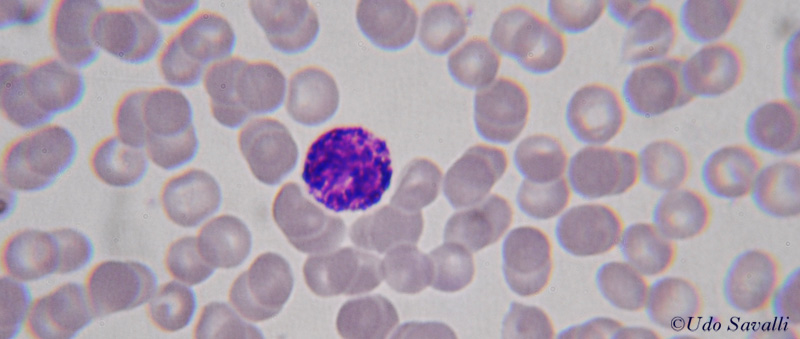 Blood Smear