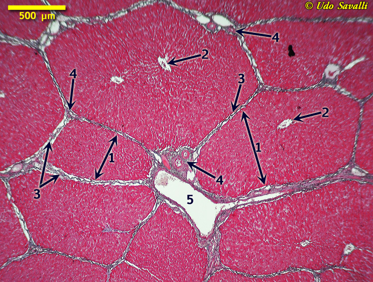 liver Histology