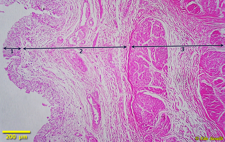 Bladder Histology