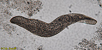 Spirostomum