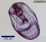 Bipinnaria Larva