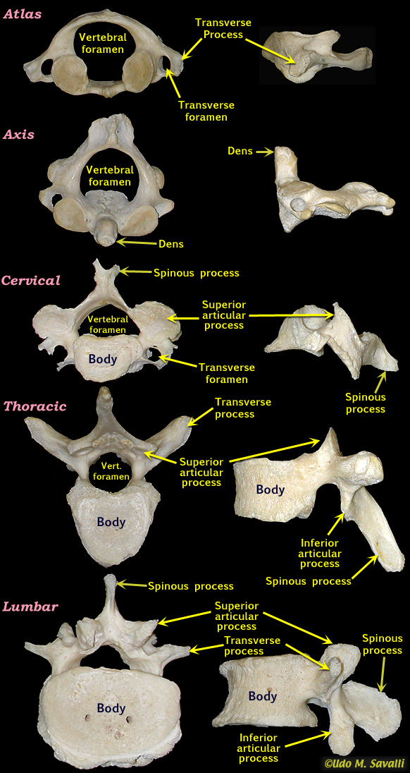cervical vertebrae labeled axis