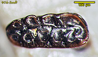 Mesodma Tooth