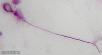 Nematocyst