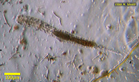 Macrodasys Gastrotrich